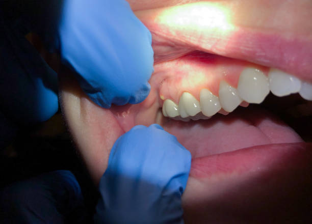 Best Emergency Dentist for Special Needs Patients in Carrollton, TX